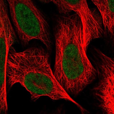 Immunocytochemistry/Immunofluorescence: CGGBP1 Antibody [NBP1-84528] - Immunofluorescent staining of human cell line U-2 OS shows localization to nucleoplasm.