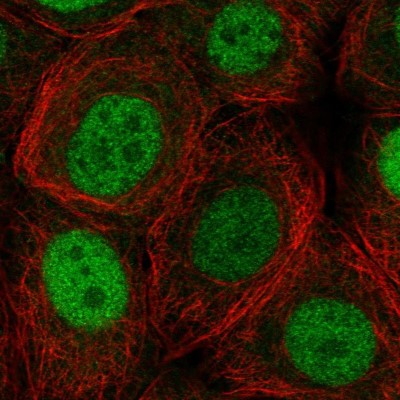 Immunocytochemistry/Immunofluorescence: COPR5 Antibody [NBP2-30884] - Immunofluorescent staining of human cell line MCF7 shows localization to nucleoplasm.