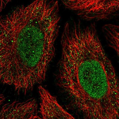 Immunocytochemistry/Immunofluorescence: ONECUT2/OC-2 Antibody [NBP2-31658] - Immunofluorescent staining of human cell line HeLa shows localization to nucleoplasm.
