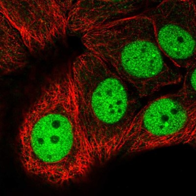 Immunocytochemistry/Immunofluorescence: MCRS1 Antibody [NBP1-81615] - Immunofluorescent staining of human cell line MCF7 shows localization to nucleoplasm.