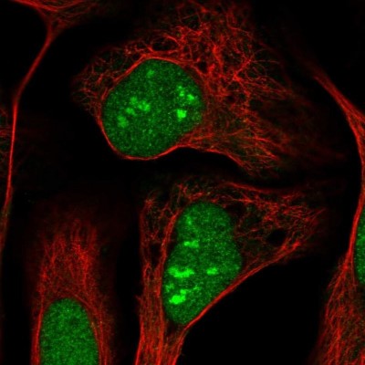 Immunocytochemistry/Immunofluorescence: DNAJC8 Antibody [NBP1-87015] - Staining  of human cell line U-2 OS shows positivity in nucleus and nucleoli.