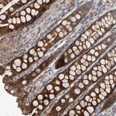 Immunohistochemistry-Paraffin: C9orf72 Antibody [NBP1-93504] - Staining of human colon shows strong cytoplasmic positivity in glandular cells.