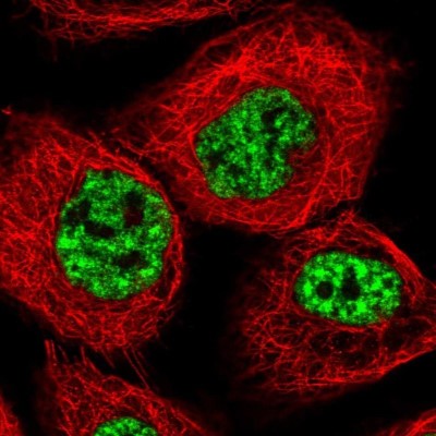 Immunocytochemistry/Immunofluorescence: CIP29 Antibody [NBP1-91788] - Staining of human cell line A-431 shows localization to nuclear speckles.
