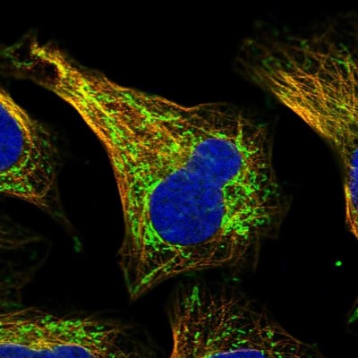 Immunocytochemistry/Immunofluorescence: SHMT2 Antibody [NBP1-80755] - Immunofluorescent staining of human cell line U-2 OS shows localization to mitochondria & microtubules.