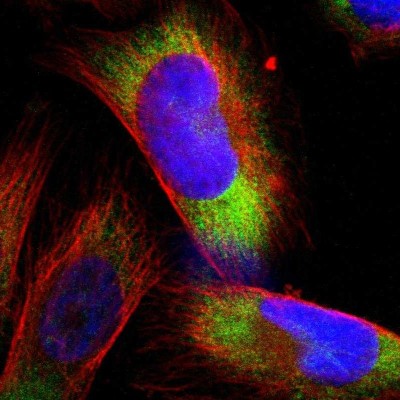 Immunocytochemistry/Immunofluorescence: RPS21 Antibody [NBP1-87100] - Immunofluorescent staining of human cell line U-251 MG shows localization to cytosol & endoplasmic reticulum.