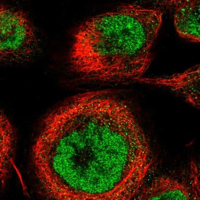 Immunocytochemistry/Immunofluorescence: CTPS2 Antibody [NBP1-86055] - Immunofluorescent staining of human cell line A-431 shows localization to nucleoplasm.