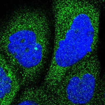 Immunocytochemistry/Immunofluorescence: RAP1GDS1 Antibody [NBP1-87027] - Staining  of human cell line A-431 shows positivity in cytoplasm.