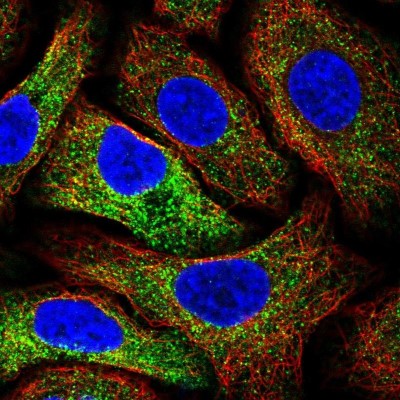 Immunocytochemistry/Immunofluorescence: MIA3 Antibody [NBP2-33770] - Immunofluorescent staining of human cell line A549 shows localization to vesicles.