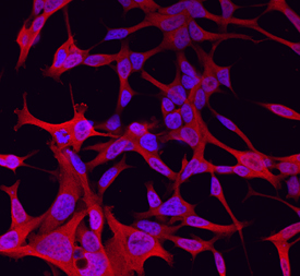 Wnt‑11 was detected in immersion fixed LNCaP human prostate cancer cell line using Goat Anti-Mouse Wnt‑11 Antigen Affinity-purified Polyclonal Antibody (Catalog # AF2647) at 10 µg/mL for 3 hours at room temperature. Cells were stained using the NorthernLights™ 557-conjugated Anti-Goat IgG Secondary Antibody (red; Catalog # NL001) and counterstained with DAPI (blue). Specific staining was localized to cytoplasm. View our protocol for Fluorescent ICC Staining of Cells on Coverslips.
