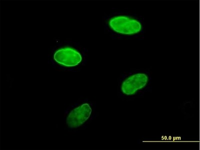 Immunocytochemistry/Immunofluorescence: Lamin B Receptor Antibody [H00003930-B01P] - Analysis of purified antibody to LBR on HeLa cell. (antibody concentration 10 ug/ml)