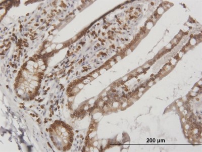 Immunohistochemistry-Paraffin: Lamin B Receptor Antibody [H00003930-B01P] - Analysis of purified antibody to LBR on formalin-fixed paraffin-embedded human small Intestine. (antibody concentration 3 ug/ml)