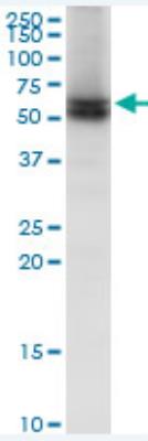 Western Blot: Lamin B Receptor Antibody [H00003930-B01P] - Expression in Jurkat.