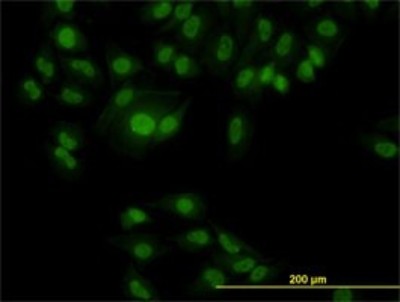 Immunocytochemistry/Immunofluorescence: FOX2 Antibody (4G3) [H00023543-M01] - Analysis of monoclonal antibody to RBM9 on HeLa cell. Antibody concentration 10 ug/ml.