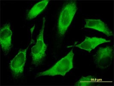 Immunocytochemistry/Immunofluorescence: CDS1 Antibody (2D10) [H00001040-M01] - Analysis of monoclonal antibody to CDS1 on HeLa cell. Antibody concentration 10 ug/ml.