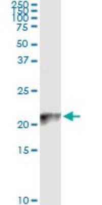 Immunoprecipitation: COX IV Isoform 2 Antibody (1F2) [H00084701-M01] - Analysis of COX4I2 transfected lysate using anti-COX4I2 monoclonal antibody and Protein A Magnetic Bead, and immunoblotted with COX4I2 MaxPab rabbit polyclonal antibody.