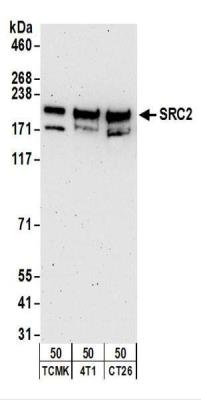 Western Blot: NCOA2 Antibody - hole cell lysate (50 ug) from TCMK-1, 4T1, and CT26.WT cells. Antibodies: Affinity purified rabbit anti-NCOA2 used for WB at 1 ug/ml. Detection: Chemiluminescence with an exposure time of 3 minutes.