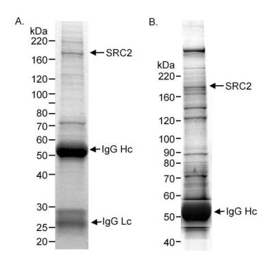 Immunoprecipitation: NCOA2 Antibody - Nuclear extract (A, 10 mg) or cytosolic (S100) extract (B, 10 mg) from HeLa cells. Antibody: Affinity purified rabbit NCOA2 used at 20 ug/10 mg lysate. Detection: Coomassie Brilliant Blue R250 staining of SDS-PAGE gel followed by mass spectrometry to confirm the identity of the band that is NCOA2.
