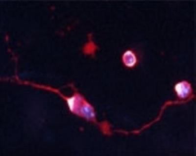 Immunocytochemistry/Immunofluorescence: Choline Acetyltransferase/ChAT Antibody [NB110-89724] - IF on 1 day- old mouse cortical cell culture using Rabbit antibody to rat, mouse ChAT (choline O-acetyltransferase):  whole serum at 1:2000 dilution. DAPI counter stained.