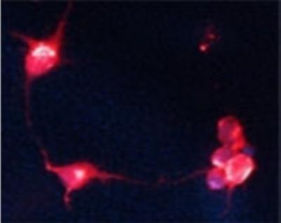 Immunocytochemistry/Immunofluorescence: Choline Acetyltransferase/ChAT Antibody [NB110-89724] - IF on 1 day- old mouse cortical cell culture using Rabbit antibody to rat, mouse ChAT (choline O-acetyltransferase):  whole serum at 1:2000 dilution. DAPI counter stained.