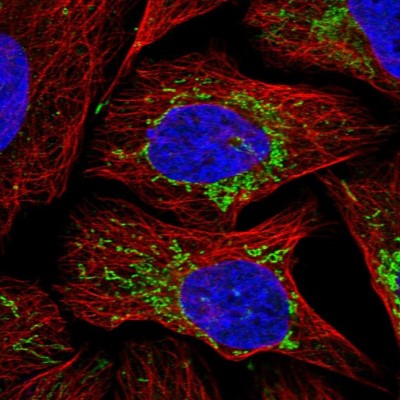 Immunocytochemistry/Immunofluorescence: TCIRG1 Antibody [NBP1-89333] - Immunofluorescent staining of human cell line U-2 OS shows localization to mitochondria.