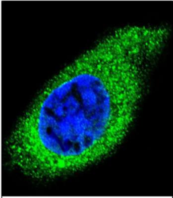 Immunocytochemistry/Immunofluorescence: Collagen XXI Antibody [NBP2-30034] - Confocal immunofluorescent analysis of COL21A1 Antibody (N-term)(NBP2-30034) with HepG2 cell followed by Alexa Fluor 488-conjugated goat anti-rabbit lgG (green). DAPI was used to stain the cell nuclear (blue).