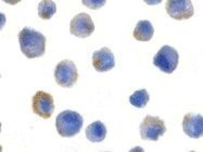 Immunocytochemistry/Immunofluorescence: FLIP Antibody [NBP1-77016] - HeLa cells with FLIP antibody at 5 ug/ml.