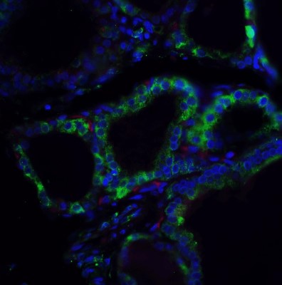 Immunocytochemistry/Immunofluorescence: R-Spondin 1 Antibody [NBP1-77354] - Staining of RSPO1 in human spleen tissue with RSPO1 antibody at 5 ug/ml.