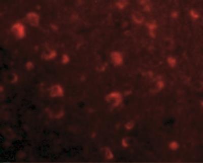 Immunocytochemistry/Immunofluorescence: SLITRK6 Antibody [NBP1-76877] - Human Brain cells with Slitrk6 antibody at 20 ug/mL.