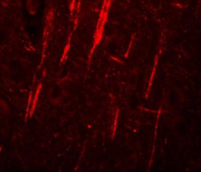 Immunofluorescence: NALP12 Antibody [NBP1-76293] - Immunofluorescence of NALP12 in human brain tissue with NALP12 antibody at 20 ug/mL.