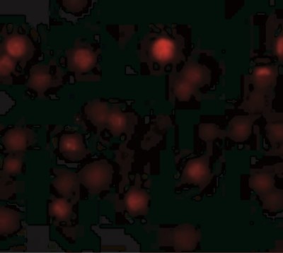Immunofluorescence: ZEB1 Antibody [NBP1-77178] - Hela cells at 20 ug/mL.