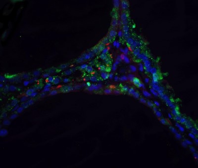 Immunocytochemistry/Immunofluorescence: DNase II Antibody [NBP1-76971] - Staining of DNase II in human spleen tissue with DNase II antibody at 5 ug/ml.