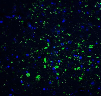 Immunocytochemistry/Immunofluorescence: CDNF Antibody [NBP1-76834] - Staining of CDNF in mouse brain tissue with CDNF Antibodyat 20 ug/mL.