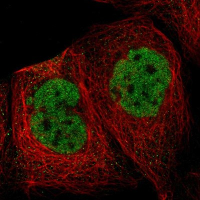 Immunocytochemistry/Immunofluorescence: Splicing Factor 1 Antibody [NBP1-86835] - Immunofluorescent staining of human cell line A-431 shows localization to nucleoplasm.