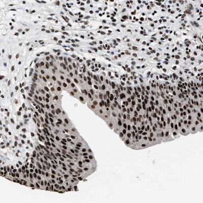 Immunohistochemistry-Paraffin: Splicing Factor 1 Antibody [NBP1-86835] - Staining of human urinary bladder shows strong nuclear positivity in urothelial cells.
