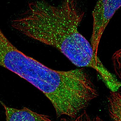 Immunocytochemistry/Immunofluorescence: RBMS3 Antibody [NBP1-89497] - Immunofluorescent staining of human cell line U-2 OS shows localization to vesicles.