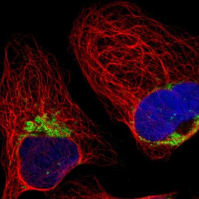 Immunocytochemistry/Immunofluorescence: HADHA Antibody [NBP1-83387] - Immunofluorescent staining of human cell line U-2 OS shows localization to mitochondria.