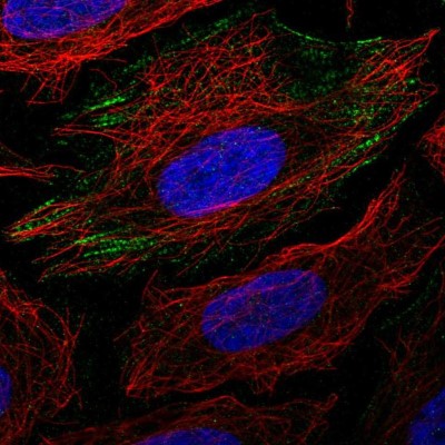 Immunocytochemistry/Immunofluorescence: PGM1 Antibody [NBP1-85982] - Immunofluorescent staining of human cell line SiHa shows localization to actin filaments.