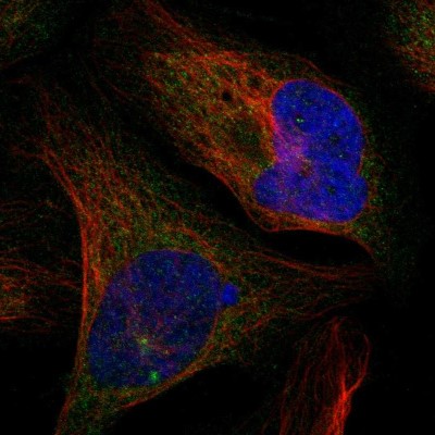 Immunocytochemistry/Immunofluorescence: CTIF Antibody [NBP1-83007] - Immunofluorescent staining of human cell line U-2 OS shows localization to cytosol.