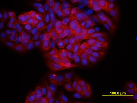 TSPAN8 was detected in immersion fixed HT‑29 human colon adenocarcinoma cell line using Rat Anti-Human TSPAN8 Monoclonal Antibody (Catalog # MAB4734) at 10 µg/mL for 3 hours at room temperature. Cells were stained using the NorthernLights™ 557-conjugated Anti-Rat IgG Secondary Antibody (red; Catalog # NL013) and counterstained with DAPI (blue). View our protocol for Fluorescent ICC Staining of Cells on Coverslips.