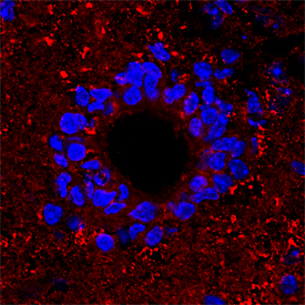 Semaphorin 4F was detected in perfusion fixed frozen sections of mouse spinal cord using Rat Anti-Mouse Semaphorin 4F Monoclonal Antibody (Catalog # MAB7200) at 25 µg/mL overnight at 4 °C. Tissue was stained using the NorthernLights™ 557-conjugated Anti-Rat IgG Secondary Antibody (red; Catalog # NL013) and counterstained with DAPI (blue). Specific staining was localized to synaptic puncta. View our protocol for Fluorescent IHC Staining of Frozen Tissue Sections. 