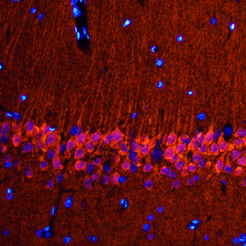 Neurogranin was detected in perfusion fixed frozen sections of rat brain (hippocampus) using Sheep Anti-Human/Mouse/Rat Neurogranin Antigen Affinity-purified Polyclonal Antibody (Catalog # AF7947) at 0.5 µg/mL overnight at 4 °C. Tissue was stained using the NorthernLights™ 557-conjugated Anti-Sheep IgG Secondary Antibody (red; Catalog # NL010) and counterstained with DAPI (blue). Specific staining was localized to pyramidal neurons in the hippocampus. View our protocol for Fluorescent IHC Staining of Frozen Tissue Sections.
