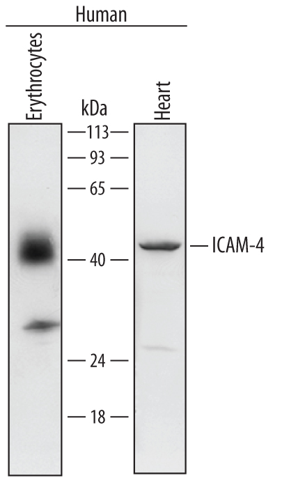 Western blot shows lysates of human erythrocytes and human heart tissue. PVDF membrane was probed with 0.2 µg/mL of Sheep Anti-Human ICAM‑4 Antigen Affinity-purified Polyclonal Antibody (Catalog # AF7179) followed by HRP-conjugated Anti-Sheep IgG Secondary Antibody (Catalog # HAF016). A specific band was detected for ICAM‑4 at approximately 42 kDa (as indicated). This experiment was conducted under reducing conditions and using Immunoblot Buffer Group 1.