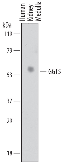 Western blot shows lysates of human kidney (medulla) tissue. PVDF membrane was probed with 1 µg/mL of Sheep Anti-Human GGT5 Antigen Affinity-purified Polyclonal Antibody (Catalog # AF7209) followed by HRP-conjugated Anti-Sheep IgG Secondary Antibody (Catalog # HAF016). A specific band was detected for GGT5 at approximately 58 kDa (as indicated). This experiment was conducted under reducing conditions and using Immunoblot Buffer Group 1.