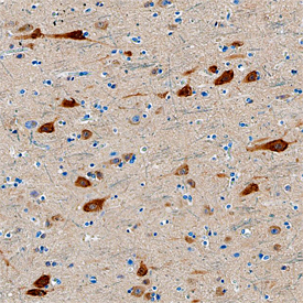 Neurogranin was detected in formalin fixed paraffin-embedded sections of human cortex using Mouse Anti-Human/Mouse/Rat Neurogranin Monoclonal Antibody (Catalog # MAB7947) at 15 µg/mL overnight at 4 °C. Tissue was stained using the Anti-Mouse HRP-DAB Cell & Tissue Staining Kit (brown; Catalog # CTS002) and counterstained with hematoxylin (blue). Specific staining was localized to neuronal cell bodies and dendrites. View our protocol for Chromogenic IHC Staining of Paraffin-embedded Tissue Sections. 