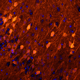 Neurogranin was detected in perfusion fixed frozen sections of mouse brain using Mouse Anti-Human/Mouse/Rat Neurogranin Monoclonal Antibody (Catalog # MAB7947) at 25 µg/mL overnight at 4 °C. Tissue was stained using the NorthernLights™ 557-conjugated Anti-Mouse IgG Secondary Antibody (red; Catalog # NL007) and counterstained with DAPI (blue). Specific staining was localized to cytoplasm in neurons. View our protocol for Fluorescent IHC Staining of Frozen Tissue Sections.