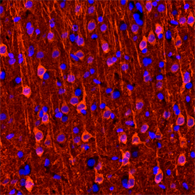 Neurogranin was detected in perfusion fixed frozen sections of rat brain using Mouse Anti-Human/Mouse/Rat Neurogranin Monoclonal Antibody (Catalog # MAB7947) at 25 µg/mL overnight at 4 °C. Tissue was stained using the NorthernLights™ 557-conjugated Anti-Mouse IgG Secondary Antibody (red; Catalog # NL007) and counterstained with DAPI (blue). Specific staining was localized to cytoplasm in neurons. View our protocol for Fluorescent IHC Staining of Frozen Tissue Sections.