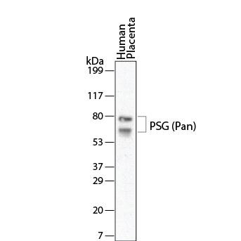 Western blot shows lysates of human placenta tissue. PVDF membrane was probed with 1 µg/mL of Mouse Anti-Human PSG Pan Specific Monoclonal Antibody (Catalog # MAB6799) followed by HRP-conjugated Anti-Mouse IgG Secondary Antibody (Catalog # HAF007). Specific bands were detected for PSG at approximately 72 and 64 kDa (as indicated). This experiment was conducted under reducing conditions and using Immunoblot Buffer Group 1.