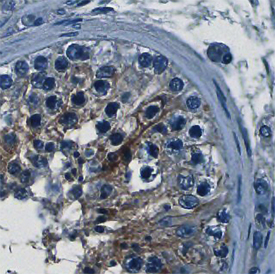 VSIG1 was detected in immersion fixed paraffin-embedded sections of human testis using Mouse Anti-Human VSIG1 Monoclonal Antibody (Catalog # MAB4818) at 15 µg/mL overnight at 4 °C. Before incubation with the primary antibody, tissue was subjected to heat-induced epitope retrieval using Antigen Retrieval Reagent-Basic (Catalog # CTS013). Tissue was stained using the Anti-Mouse HRP-DAB Cell & Tissue Staining Kit (brown; Catalog # CTS002) and counterstained with hematoxylin (blue). Specific staining was localized to plasma membranes in spermatocytes. View our protocol for Chromogenic IHC Staining of Paraffin-embedded Tissue Sections.