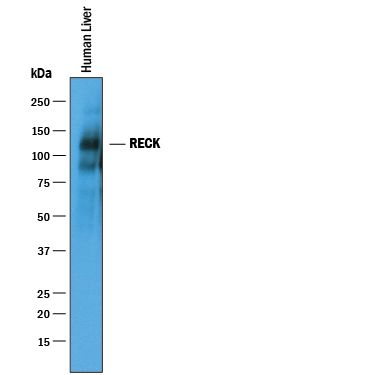 Western blot shows lysates of human liver tissue. PVDF membrane was probed with 1 µg/mL of Goat Anti-Human RECK Antigen Affinity-purified Polyclonal Antibody (Catalog # AF1734) followed by HRP-conjugated Anti-Goat IgG Secondary Antibody (Catalog # HAF019). A specific band was detected for RECK at approximately 130 kDa (as indicated). This experiment was conducted under reducing conditions and using Immunoblot Buffer Group 1.