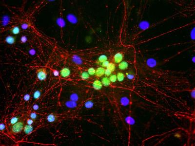 Immunocytochemistry/Immunofluorescence: A2BP1 Antibody (1G10) [NBP2-25141] - Rat brain neural cultures stained with NBP2-25141 (green), rabbit polyclonal antibody to NF-M: NB300-133 (red) and DNA (blue). The NBP2-25141 antibody reveals nuclear and distal cytoplasmic staining for A2BP1 and the complete absence of staining of non-neuronal cells.